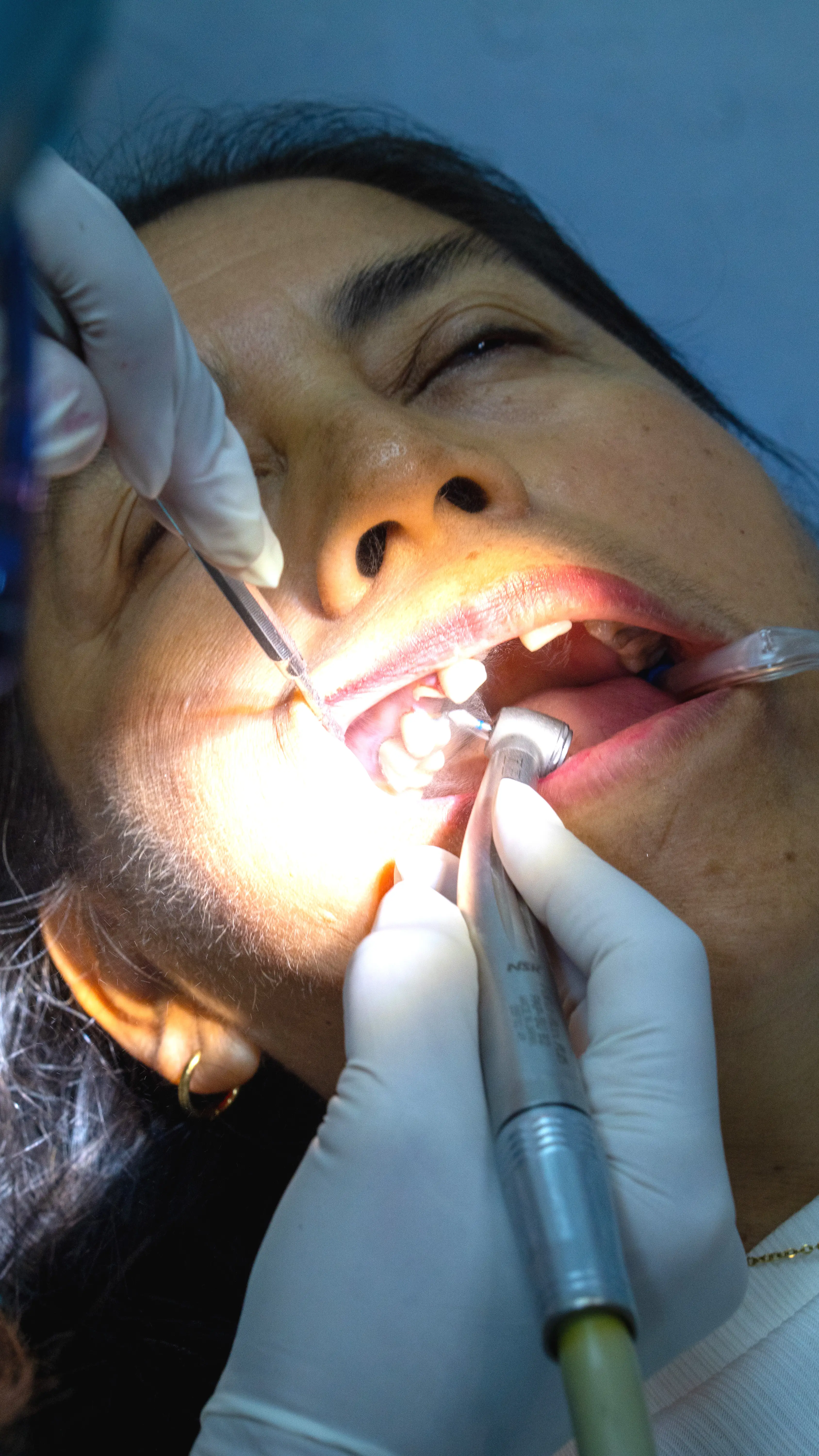 Paciente 1 - Clínica Dental Alcívar