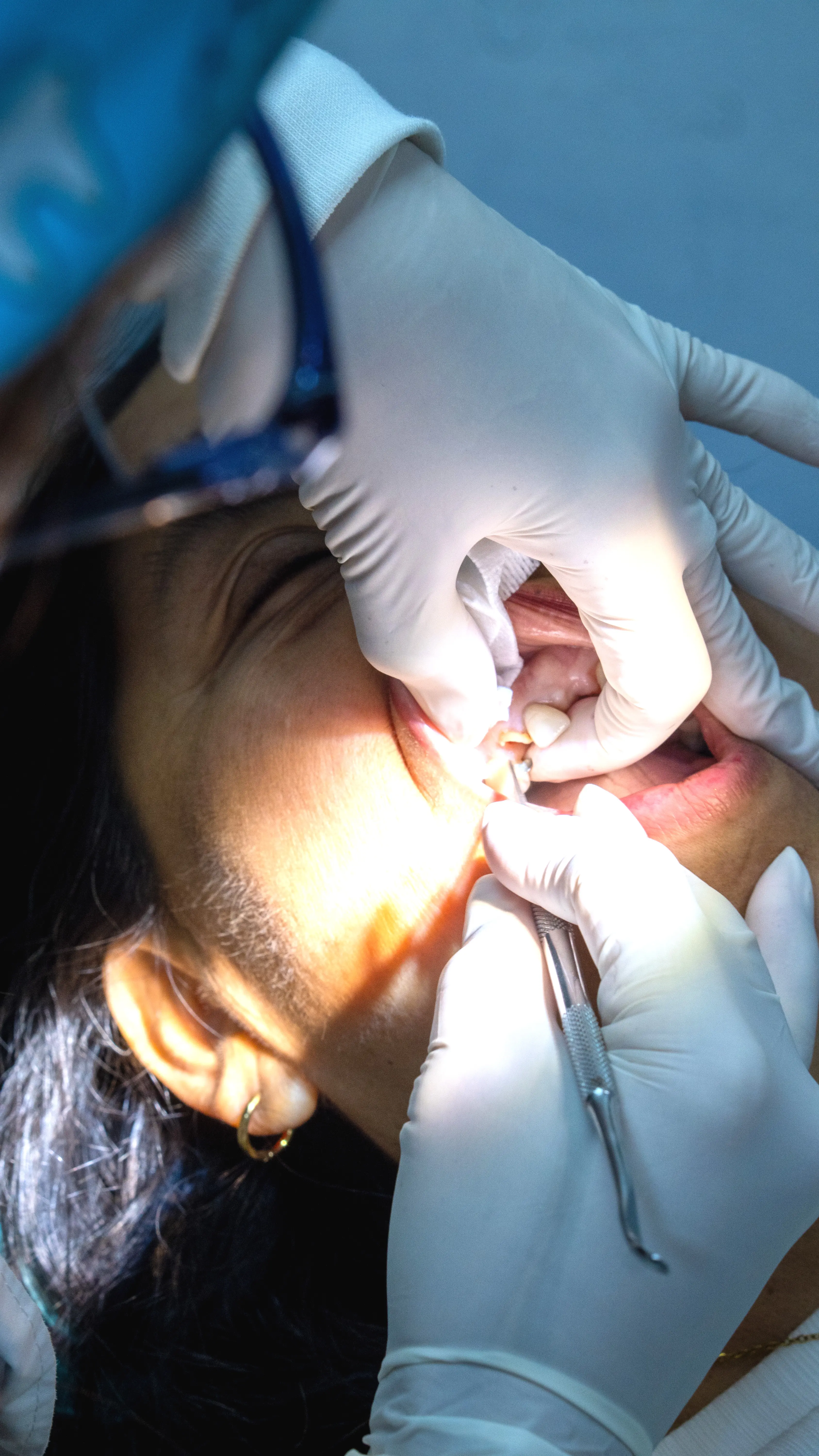 Paciente 3 - Clínica Dental Alcívar